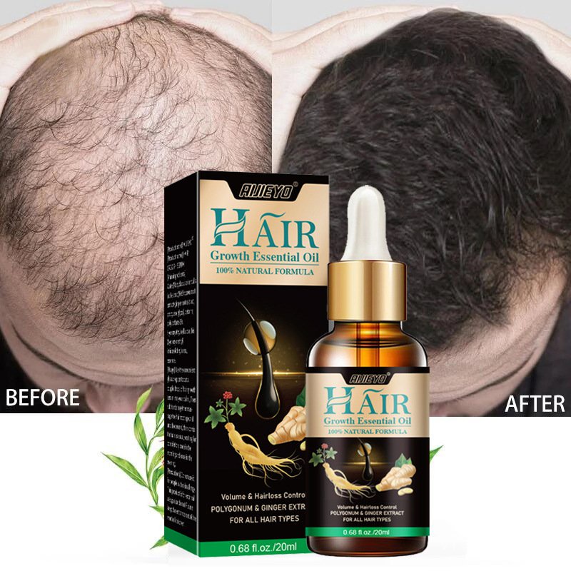 AIJIEYOSend Ginger Hair Nutrient Solution Ginger Ginger Hair Liquid Ginger Hair Nutrient Solution